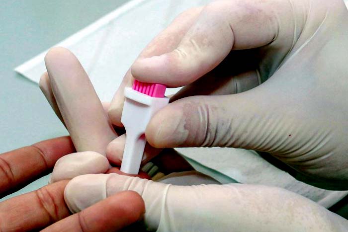 Agevisa orienta para uso de novo método prevenção ao HIV
