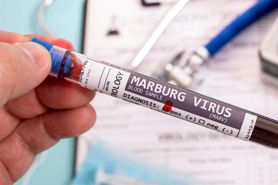 Guiné Equatorial confirma primeiro surto do vírus de Marburg