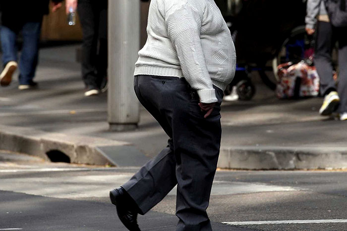 ANS vai ter regras para monitorar obesidade